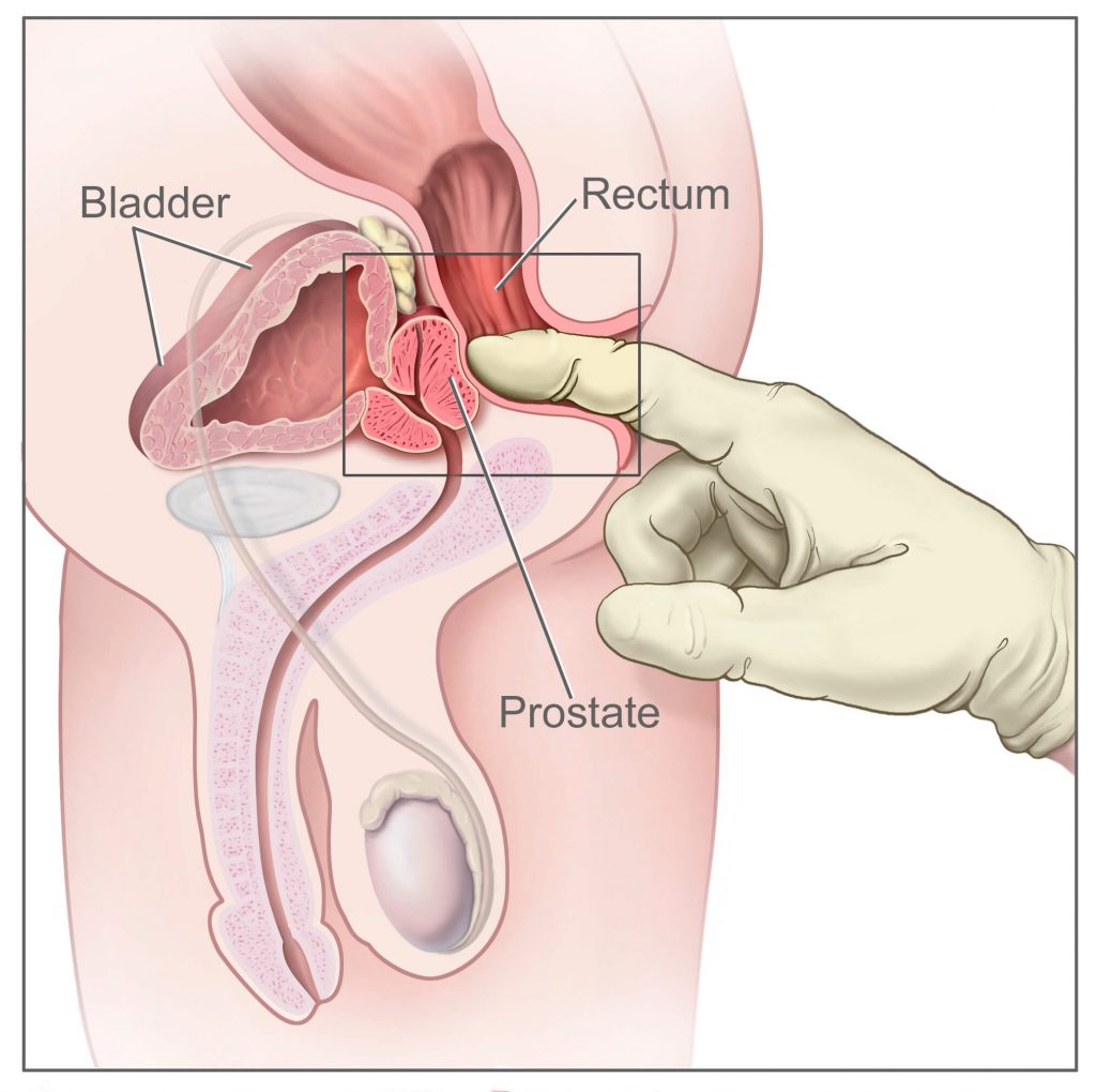 Finding The Prostate
